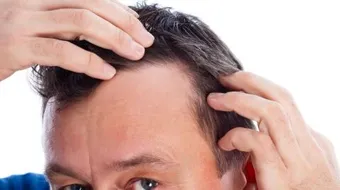 ما هو سبب ظهور الشعر الابيض