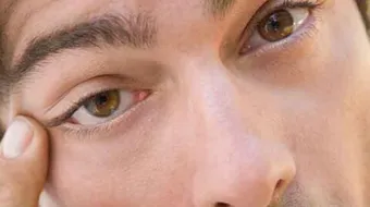 ما سبب رفرفة العين