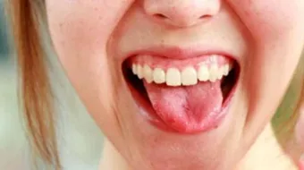 ما سبب ثقل اللسان