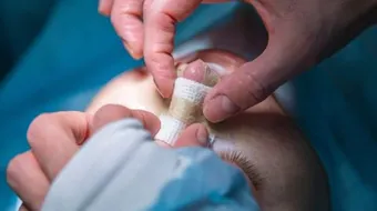 ما حكم عملية تجميل الانف