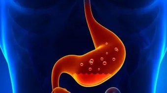 ما علاج حرقان المعدة للحامل