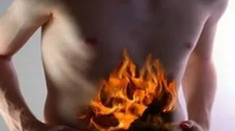 ما علاج حرقة المعدة