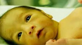 ما هو علاج اليرقان