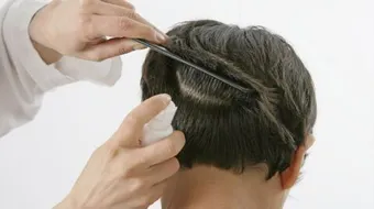 ما هو علاج القمل وبيضه