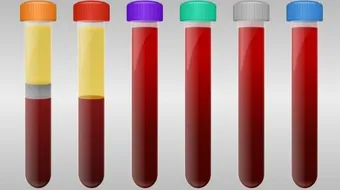 ما هو علاج تخثر الدم
