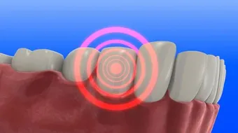 ما علاج ألم الأسنان