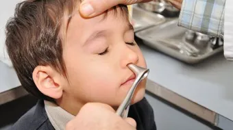 ما هو علاج احتقان الأنف