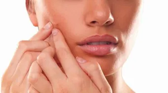 ما علاج الحبوب في الوجه