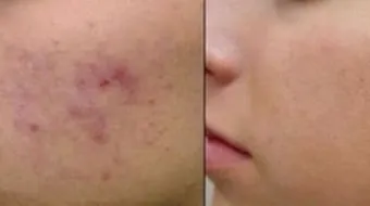 ما فائده طين البحر الميت للوجه