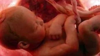 ما هي الطريقة لمعرفة نوع الجنين