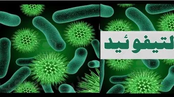 ما هي حمى التيفود