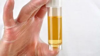 ما هو زلال البول