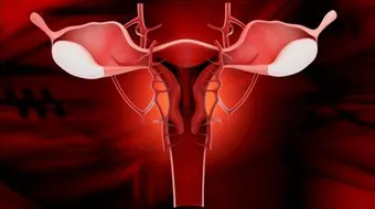 ما هو النزيف الرحمي