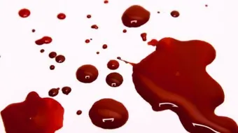 ما هو النزيف المهبلي