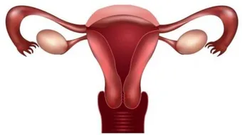 ما هو ضعف التبويض