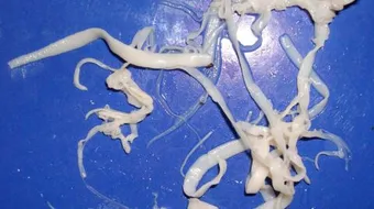 ما طرق العلاج من الإصابة بدودة البقر الشريطية