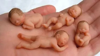 متى تلجأ المرأة لطفل الأنابيب؟