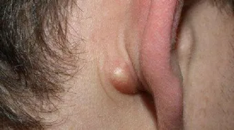 أين توجد الغدد الليمفاوية