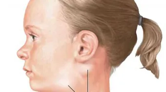 أين توجد الغدد اللمفاوية في الجسم