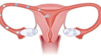 أين توجد قناة فالوب