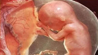 أين يكون رأس الجنين في الشهر السادس