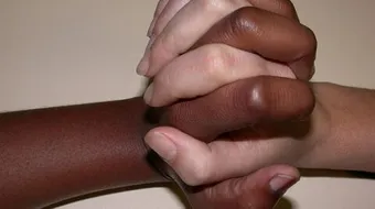 أين توجد صبغة الميلانين