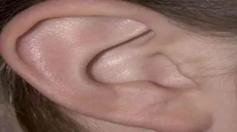 أين توجد عظمة الركاب في جسم الإنسان