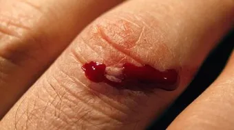 أين توجد البلازما في الجسم