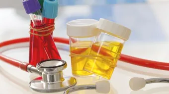 لماذا البول لونه أحمر