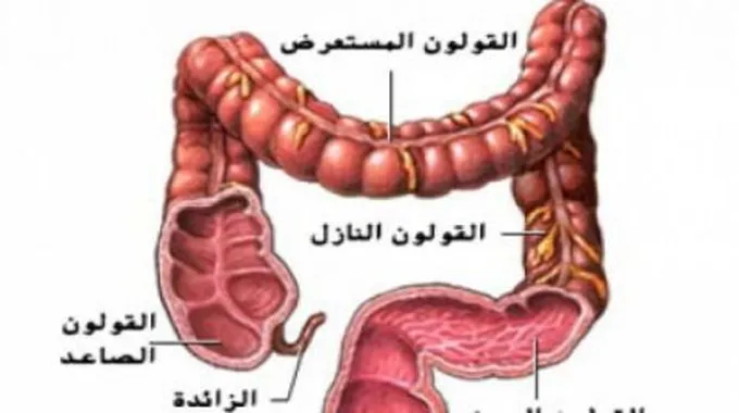 هل القولون يسبب فقدان الشهية