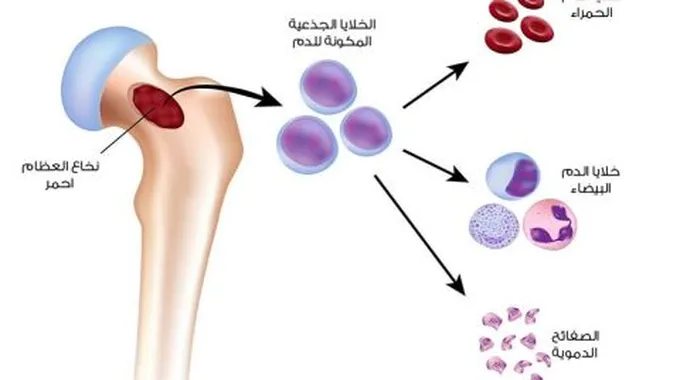 أعراض فقر الدم وأسبابه