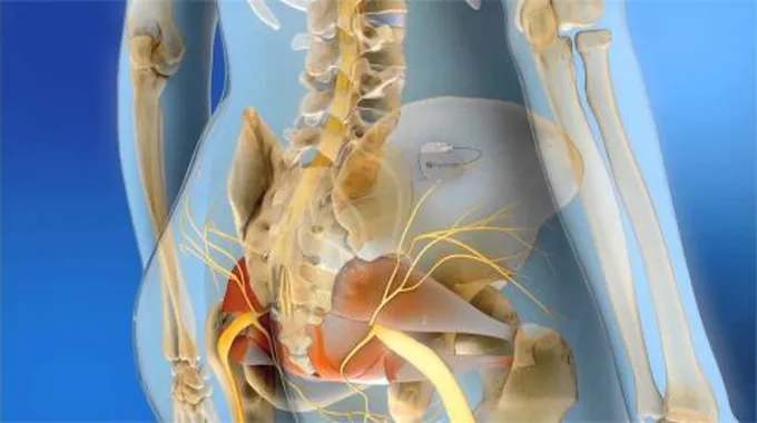 علاج الأعصاب