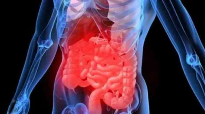 ما هي بكتيريا القولون