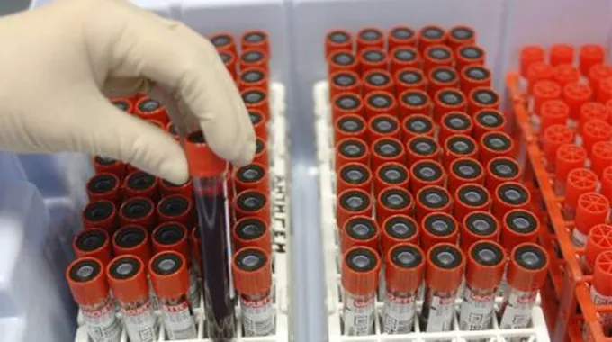 ما هي خصائص فصيلة الدم O-