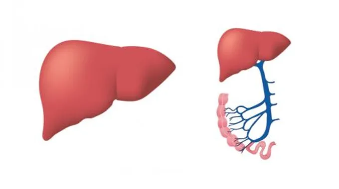 ما هو تضخم الكبد وعلاجه