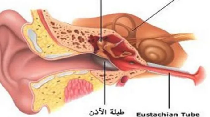 بماذا تسمى قناة أستاكيوس